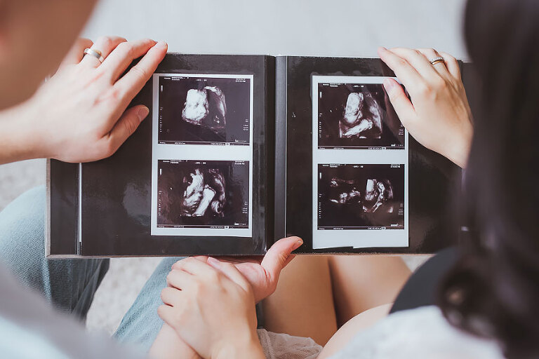 孕婦寫真, 孕婦寫真推薦,台北孕婦寫真,宜蘭孕婦寫真,台中孕婦寫真,孕婦照,新生兒寫真,寶寶寫真,女婚攝推薦,女攝影師, 卡菲小姐, 風雲20攝影師, 孕婦寫真服裝,孕婦寫真週數,孕婦寫真價格,孕婦寫真自助,孕婦禮服,孕婦寫真洋裝,孕婦寫真造型,孕婦寫真價位,台北親子寫真,親子寫真,親子寫真推薦,親子寫真服裝,親子寫真價格,親子寫真氣球,家庭寫真,全家福,兒童寫真推薦,兒童寫真台北,親子照,抓週寫真,生日派對寫真,新生兒寫真價格,新生兒寫真到府,新生兒寫真方案,寫真攝影棚,吳鳳孕婦照,藝人孕婦寫真,楊千霈孕婦照,安以軒孕婦照,Janet孕婦寫真,Angelababy孕婦寫真,寶寶寫真主題,新生兒寫真主題,昆凌孕婦照,Ms. kaffi 卡菲小姐,newborn Photos,pregnancy photo,family photography